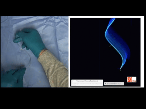 Paired frames, on left hands manipulating tubular device, on right depiction of device in virtual environment
