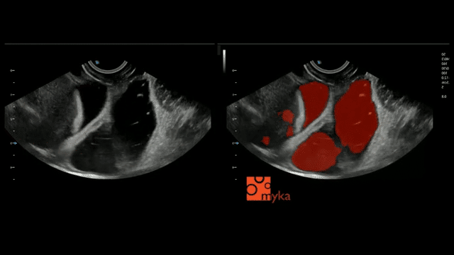 Sonograms, left side standard, right side with augmentation